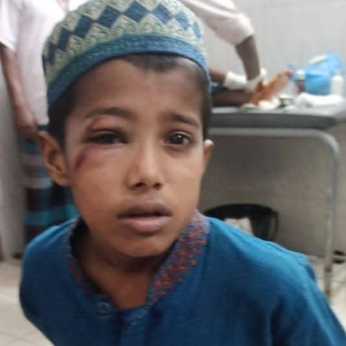 ছাত্রকে বেত্রাঘাত করা সেই মাদ্রাসার শিক্ষকের বিরুদ্ধে গোয়াইনঘাট থানায় অভিযোগ হয়েছে